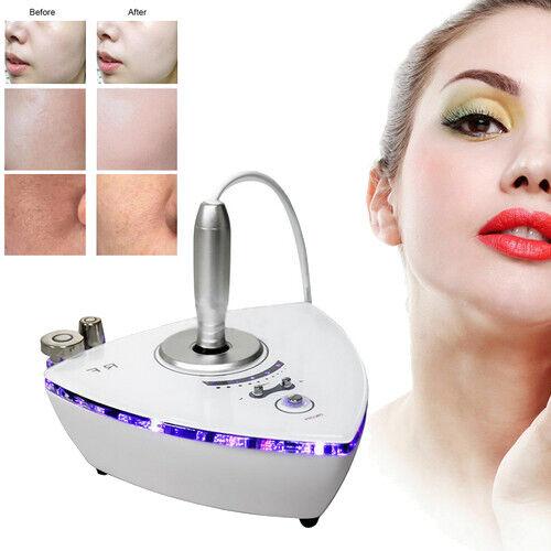 (Only sent to Europe) Winkle Removal Beauty Facial Beauty Machine Radio Skin Frequency 3 in 1